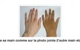 Réaction à l'alcool