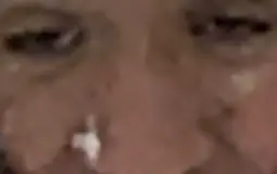 Syndromoe