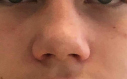 Klaras attention tier list