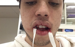 The Ultimate Chip Tier List