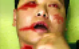 terms of annoying-ness